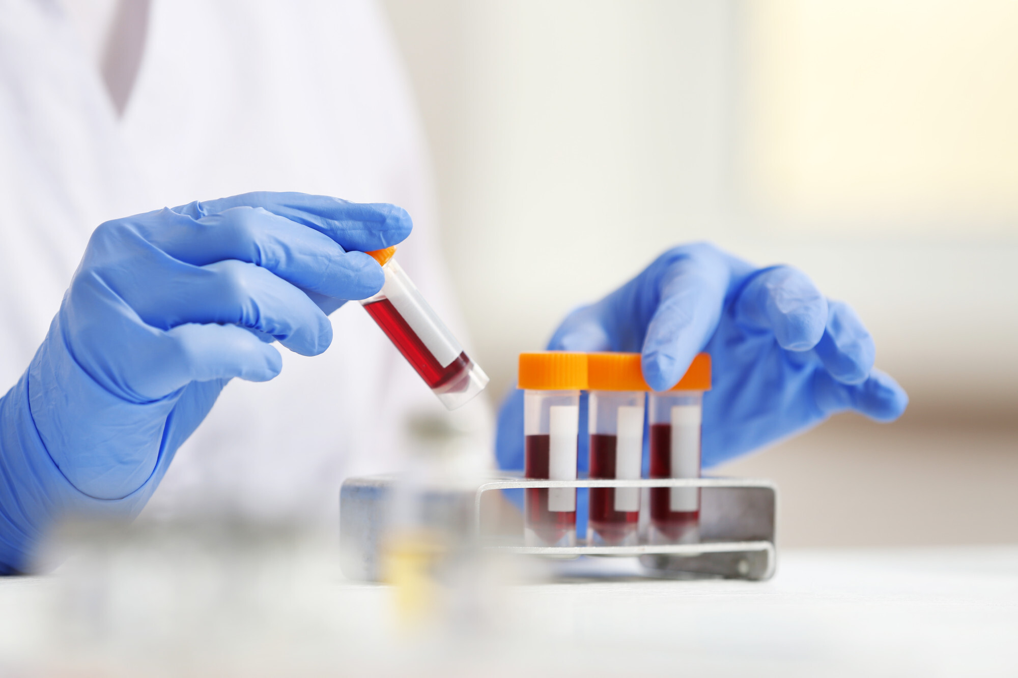 Blood bank temperature monitoring in laboratory